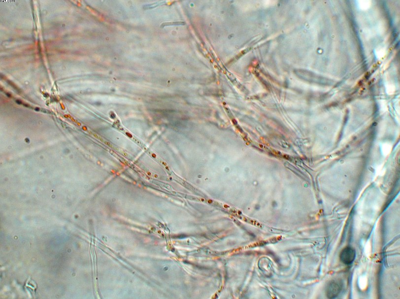 Sarcoscypha jurana       (Boud.)      Baral